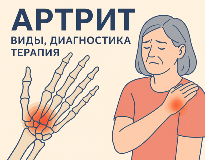 Артрит: виды, диагностика, терапия