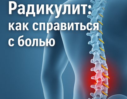 Радикулит: как справиться с болью